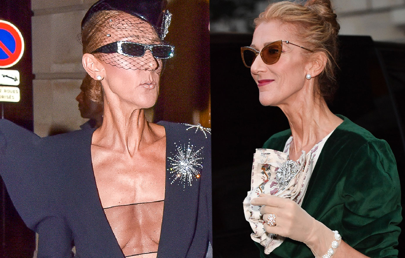 is celine dion anorexics